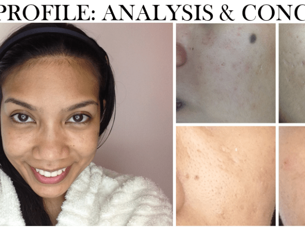 Skin Profile and&nbsp;Story