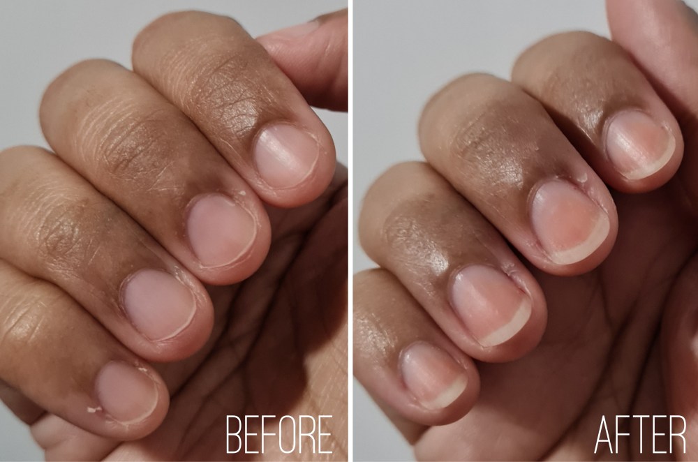 Kinohimitsu MarineGem Collagen Powder Before and After Results