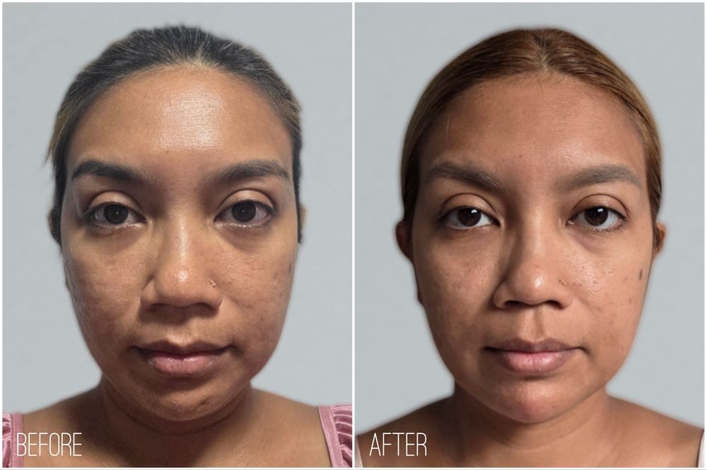 ZIIP HALO: A Microcurrent Facial Device for Sculpting and Tightening at Home